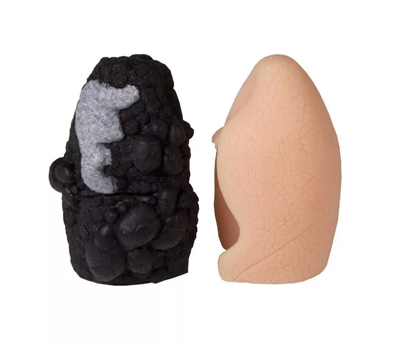 Model porównawczy raka płuc