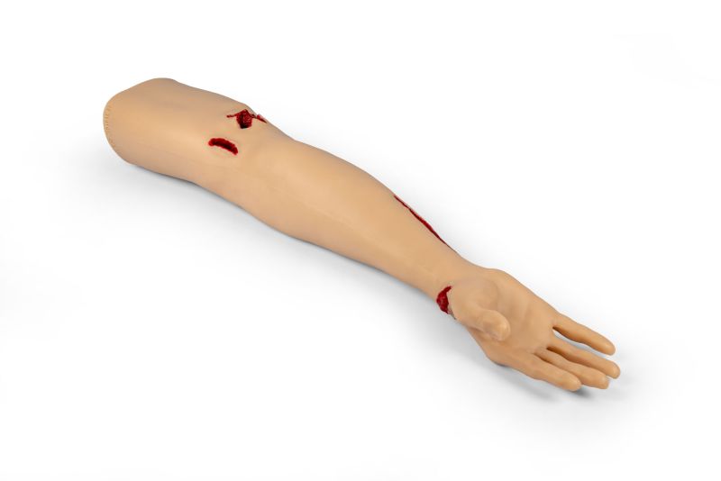 Ramię z krwawiącymi ranami - Trauma Tina - obrazek 2
