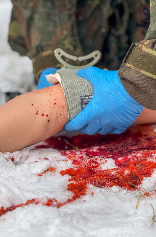 Ramię z krwawiącymi ranami - Trauma Tina - obrazek 3